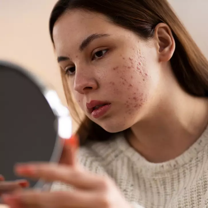 10 Toner menghilangkan jerawat harga di bawah Rp 200 ribu