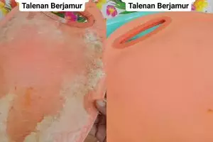 Solusi mudah atasi talenan plastik lama yang berjamur, cukup direndam 2 bahan rumahan ini