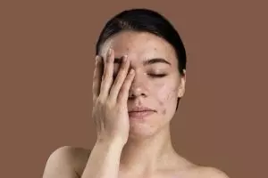 10 Serum menghilangkan pori-pori wajah di bawah Rp 100 ribu