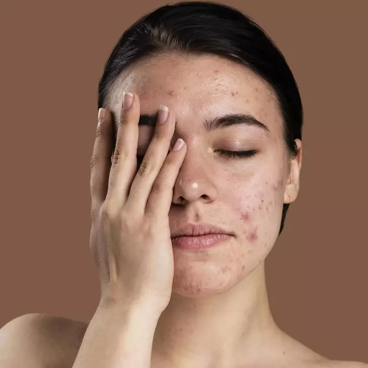 10 Serum menghilangkan pori-pori wajah di bawah Rp 100 ribu