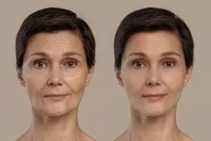 Bukan pakai masker dari beras, ini cara hilangkan kerutan dan kulit kendur pakai 1 jenis sayuran