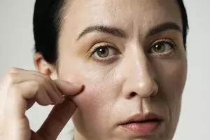 7 Krim menghilangkan pori-pori wajah di bawah Rp 100 ribu