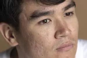 10 Serum mengecilkan pori-pori wajah kencang lagi, harga di bawah Rp 50 ribu