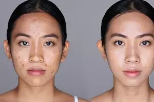 Kulit mulus instan, begini tutorial makeup 2025 untuk nutupin jerawat dengan natural