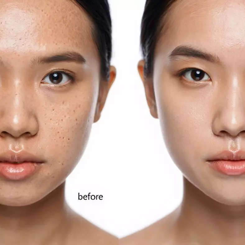 Inilah 5 kebiasaan sehari-hari yang efektif mengecilkan pori-pori, kulit lebih mulus tanpa ribet