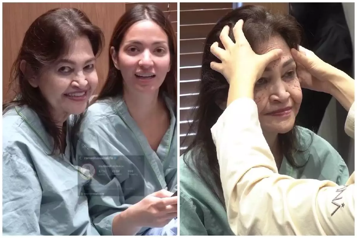 Wajah kendur di usia 65, ibunda Nia Ramadhani oplas di Korea Selatan, ini 7 potretnya sebelum tindakan