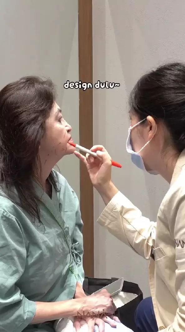 ibunda Nia Ramadhani oplas © Instagram