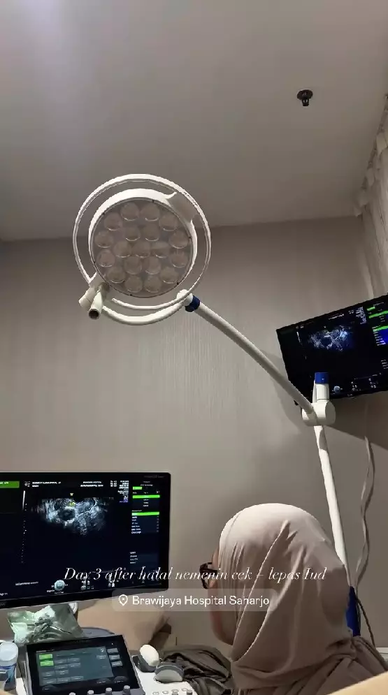  Clara Shinta putuskan lepas KB IUD © Instagram