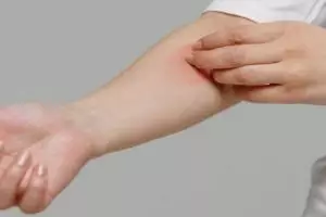 Alami dan cepat, begini trik menghilangkan gatal-gatal pada kulit pakai bahan dapur