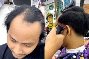 Pria botak U distyling jadi lebih muda, transformasinya bikin melongo