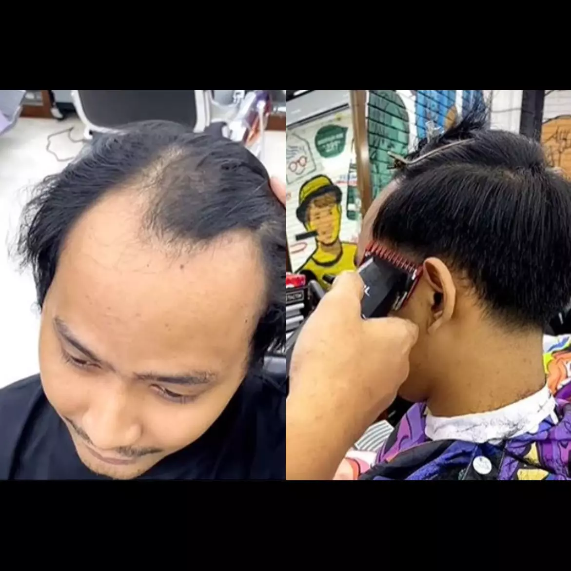 Pria botak U distyling jadi lebih muda, transformasinya bikin melongo