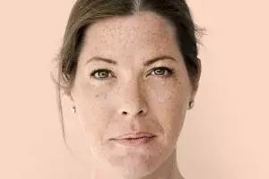 10 Serum menghilangkan flek hitam harga di bawah Rp 200 ribu