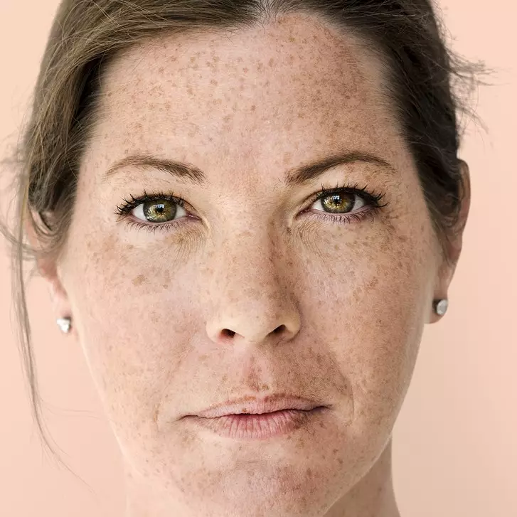 10 Serum menghilangkan flek hitam harga di bawah Rp 200 ribu