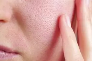 Pori-pori kulit tak tersumbat lagi, pakai 1 sumber protein, nggak harus pakai air mawar