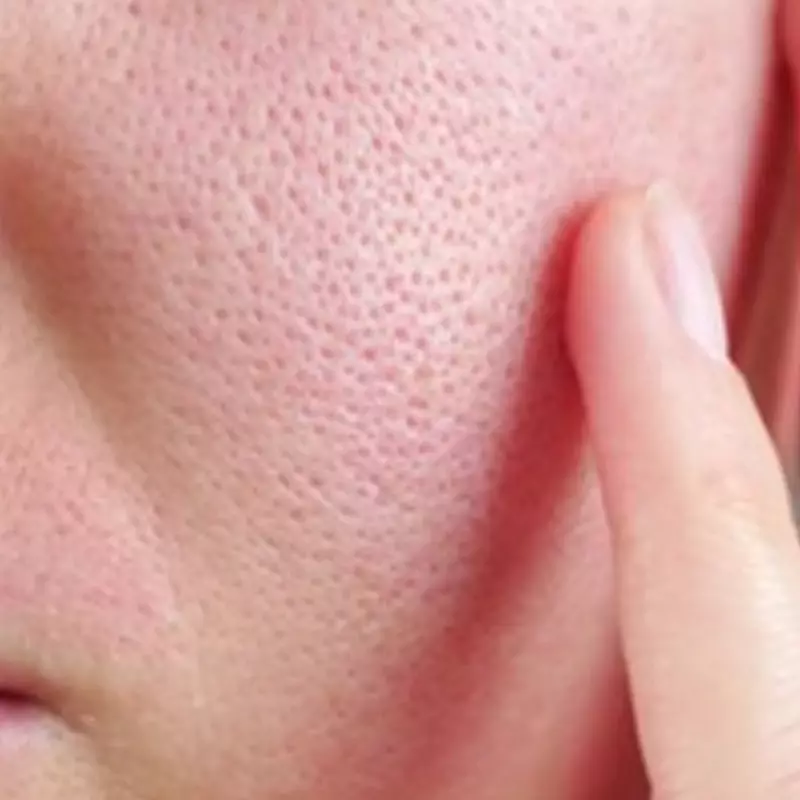 Pori-pori kulit tak tersumbat lagi, pakai 1 sumber protein, nggak harus pakai air mawar