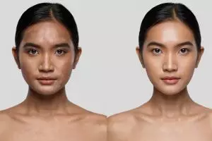 Cara cepat mencerahkan kulit kusam dengan bahan alami, hasil terlihat dalam 7 hari