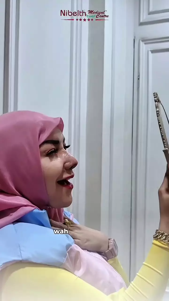 Potret terbaru Roro Fitria usai oplas © 2025 Instagram