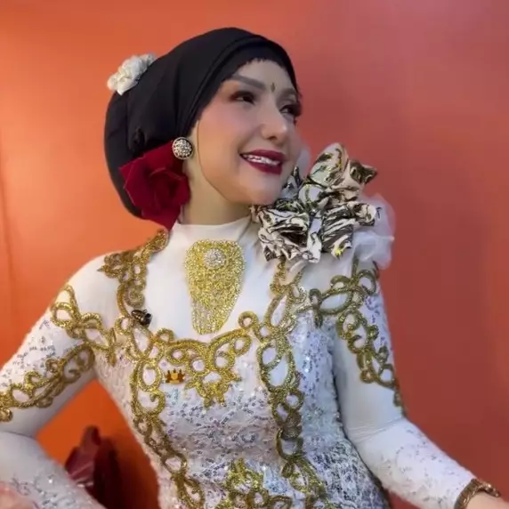 9 Potret terbaru Roro Fitria usai operasi plastik bagian hidung, dipuji makin cantik