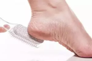 Kaki mulus dalam 10 menit, ini rahasia atasi tumit pecah-pecah dan dekil pakai 1 bahan herbal saja