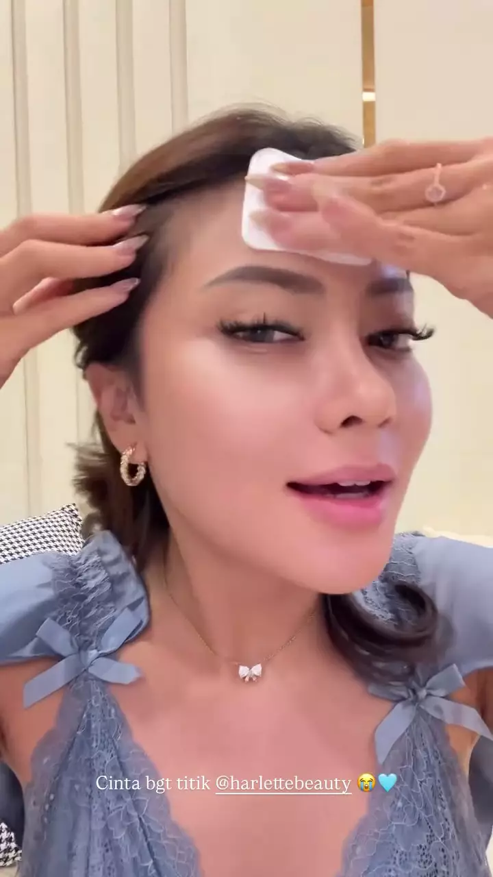 Hanum Mega operasi plastik hidung © 2025 Instagram Hanum Mega operasi plastik hidung © 2025 Instagram