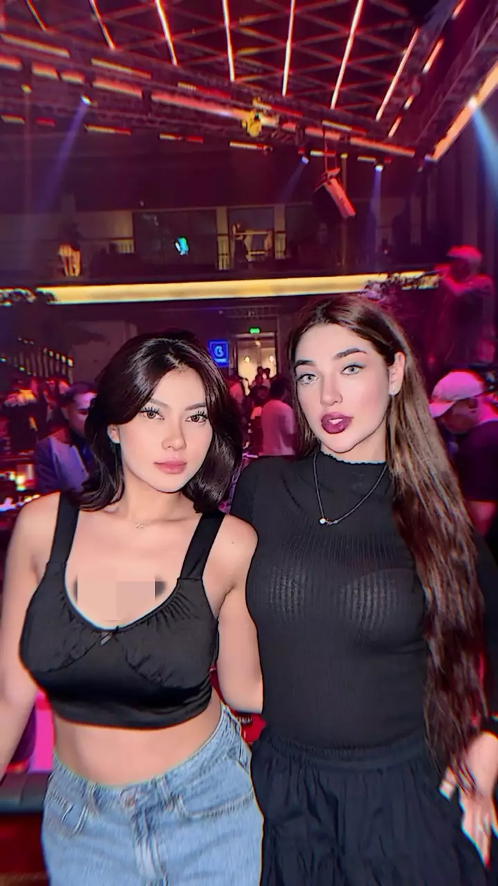 Hanum Mega operasi plastik hidung © 2025 Instagram Hanum Mega operasi plastik hidung © 2025 Instagram