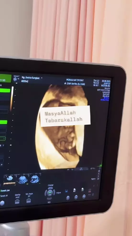 Zaskia Sungkar umumkan kehamilan kedua © Instagram Zaskia Sungkar umumkan kehamilan kedua © Instagram