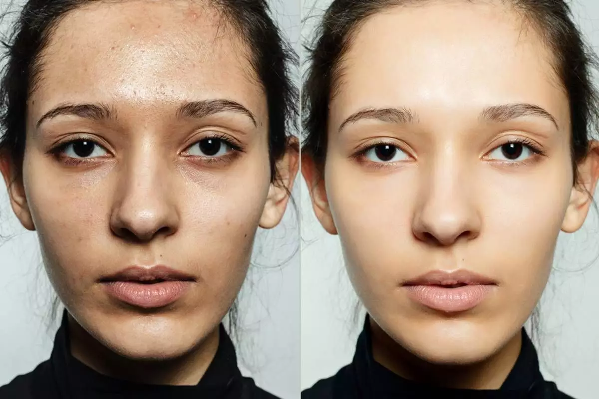 Pengin wajah cerah alami? Coba bikin facial scrub pakai 1 bumbu dapur ini buat angkat sel kulit mati