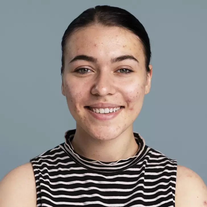 10 Toner mencegah jerawat muncul lagi, wajah kembali berseri cantik harga di bawah Rp 100 ribu