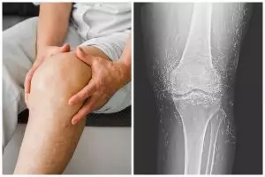 Bikin syok, dokter ini temukan benang susuk emas di lutut pasien saat lakukan rontgen