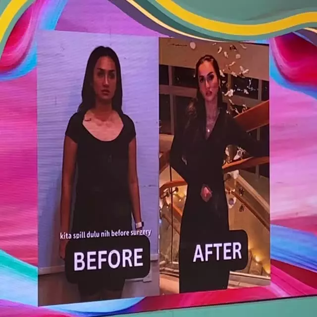 Tengku Dewi operasi percantik tubuh di Korea © 2025 brilio.net Tengku Dewi operasi percantik tubuh di Korea © 2025 brilio.net