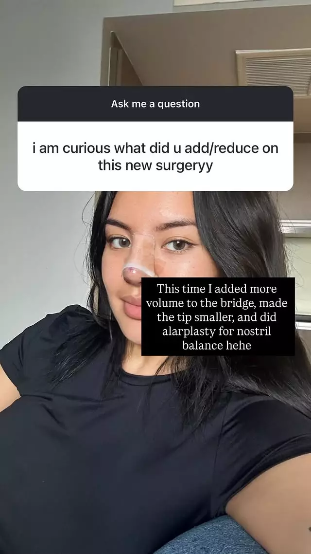 cerita Shafa Harris operasi di Thailand © Instagram cerita Shafa Harris operasi di Thailand © Instagram