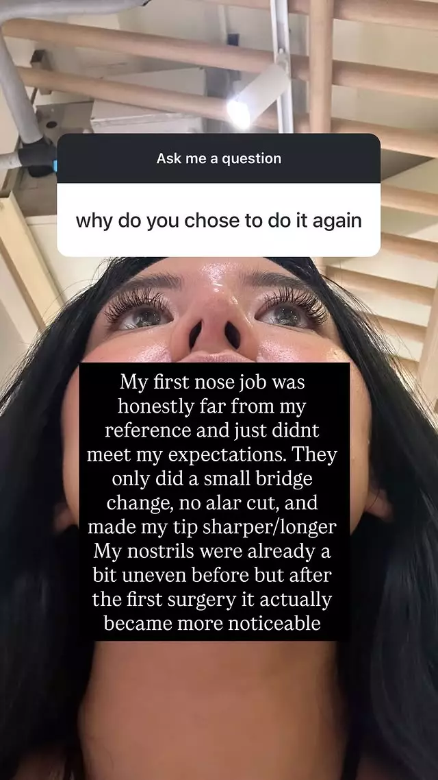 cerita Shafa Harris operasi di Thailand © Instagram cerita Shafa Harris operasi di Thailand © Instagram