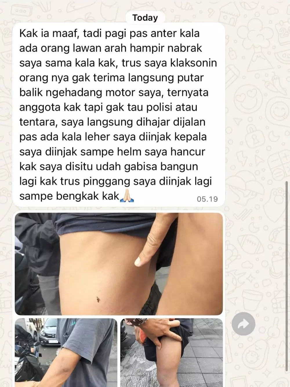 Karyawan Zaskia Adya Mecca dianiaya oknum anggota © 2025 Instagram