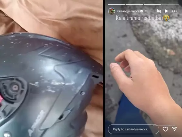 Karyawan Zaskia Adya Mecca dianiaya oknum anggota © 2025 Instagram