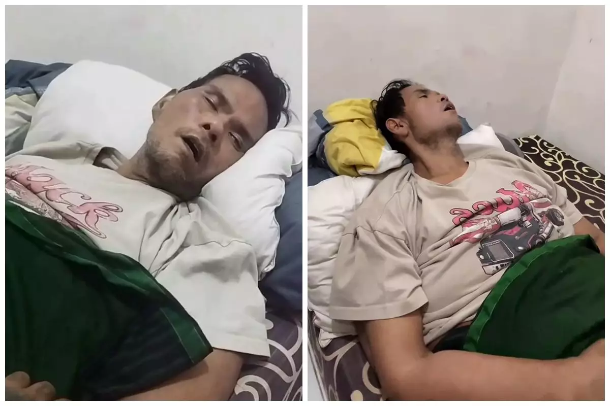 9 Potret kondisi Fahmi Bo makin memprihatinkan alami komplikasi, tubuh makin kurus dan sulit bangun
