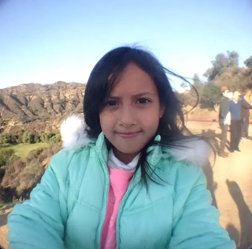 transformasi Aiska Vairana putri sulung Ersa © Instagram