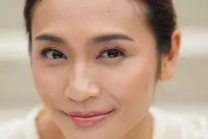 5 Cara mengurangi smile line tanpa operasi, aman dan efektif