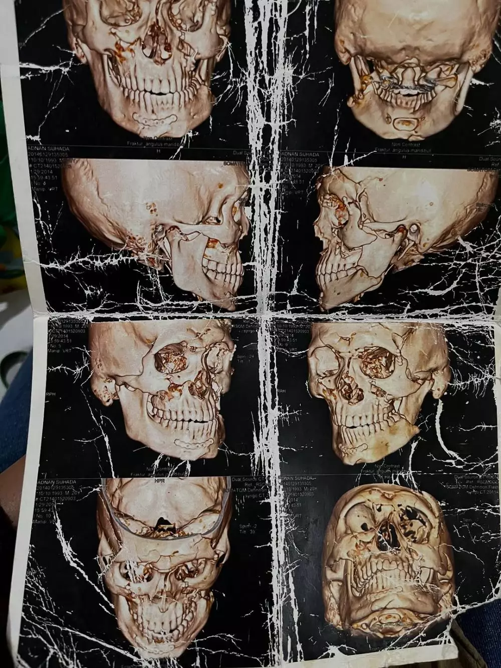 Kronologi kasus tabrak lari yang menyerat Nadya Almira © 2025 brilio.net Kronologi kasus tabrak lari yang menyerat Nadya Almira © 2025 brilio.net