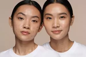 5 Trik basic skincare yang benar untuk wajah bruntusan, wajah kembali mulus dalam 7 hari