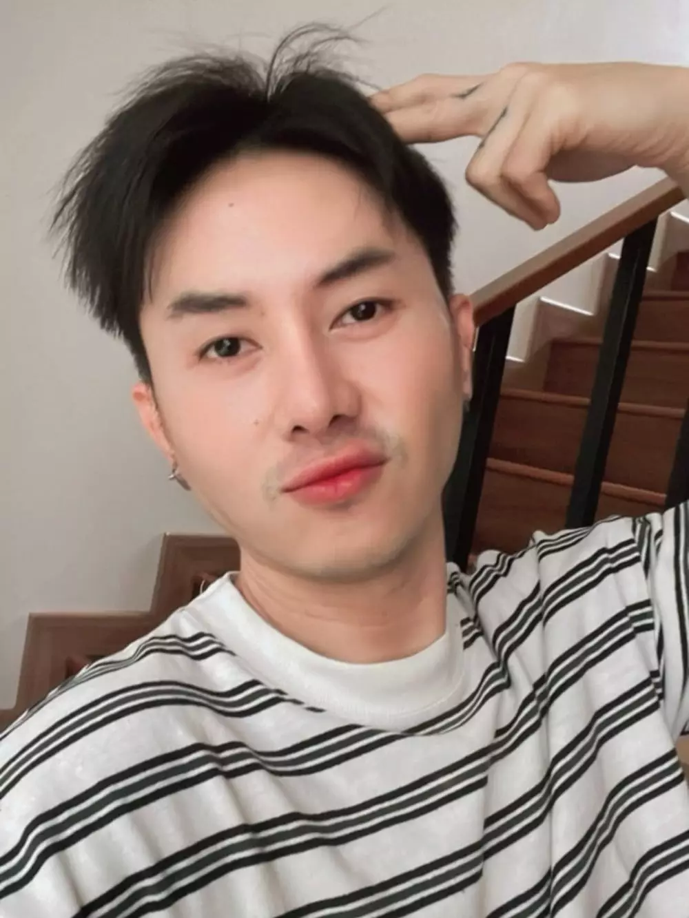 Rafael Tan oplas karena alami masalah mata © 2025 Instagram