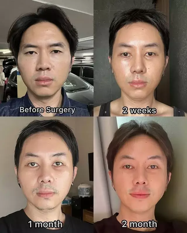 Rafael Tan oplas karena alami masalah mata © 2025 Instagram