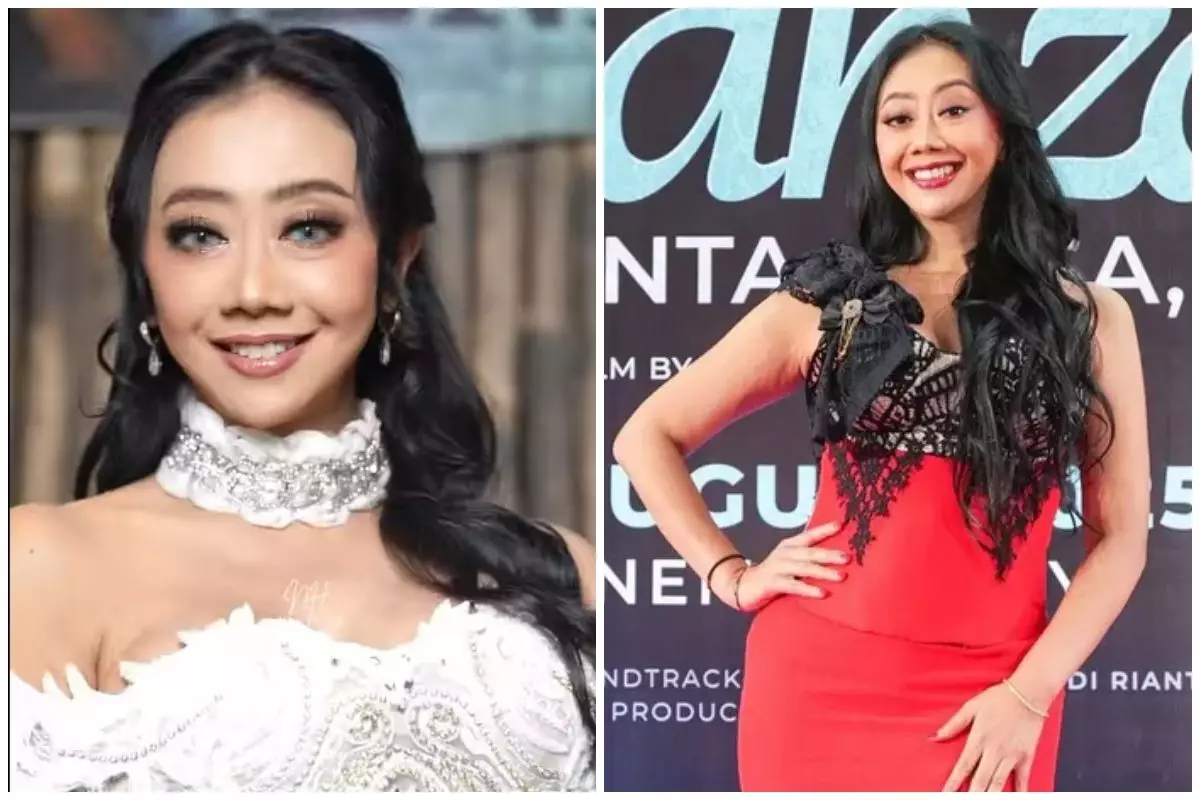 Tak malu akui oplas, Asri welas bagikan potret sebelum dan sesudah operasi anti-aging, dipuji natural