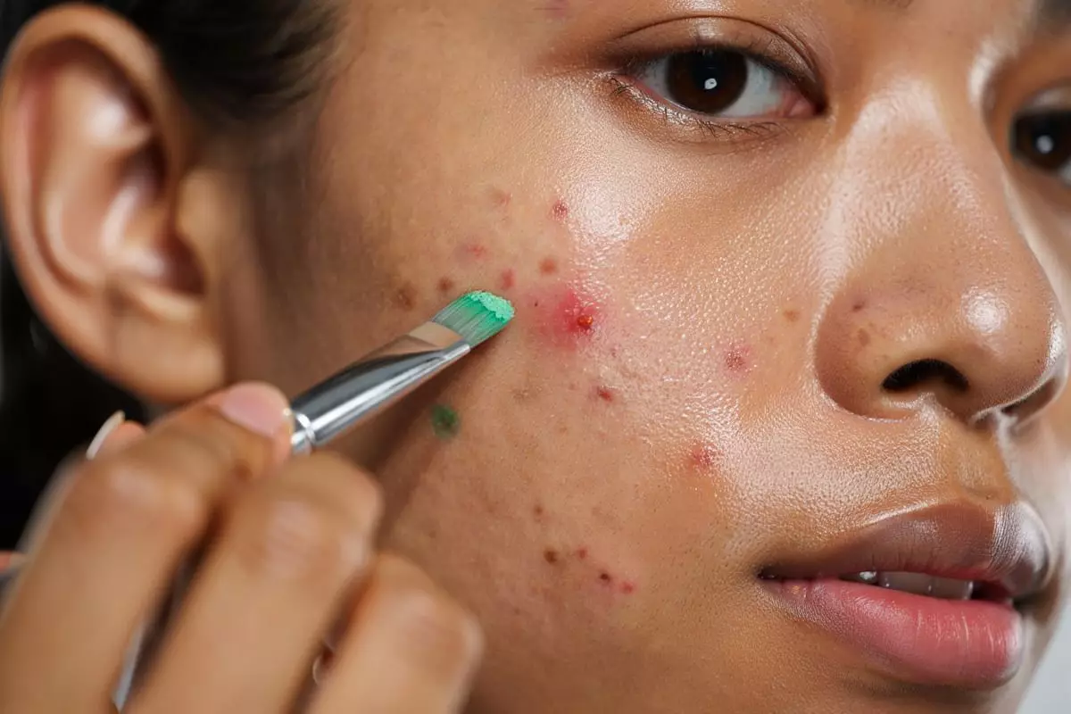 8 Color corector di bawah Rp100 ribu, solusi cepat tutupi jerawat dan bekasnya dengan hasil natural