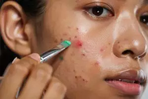 8 Color corector di bawah Rp100 ribu, solusi cepat tutupi jerawat dan bekasnya dengan hasil natural