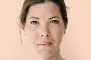 10 Serum untuk wajah bruntusan harga di bawah Rp 150 ribu, mencerahkan kulit