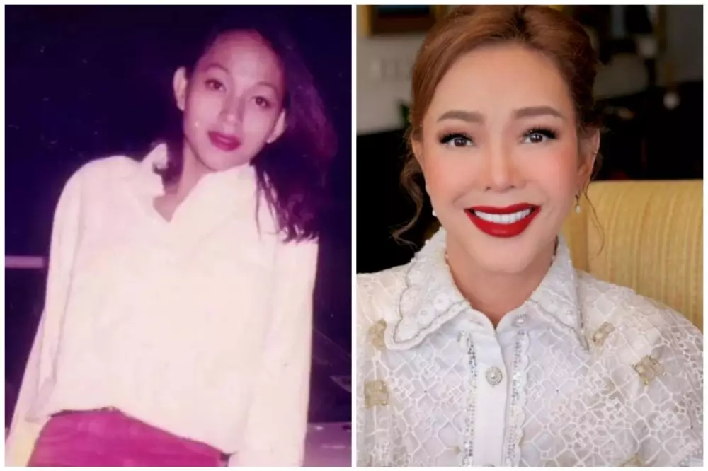 seleb 50an sebelum sesudah operasi plastik © berbagai sumber