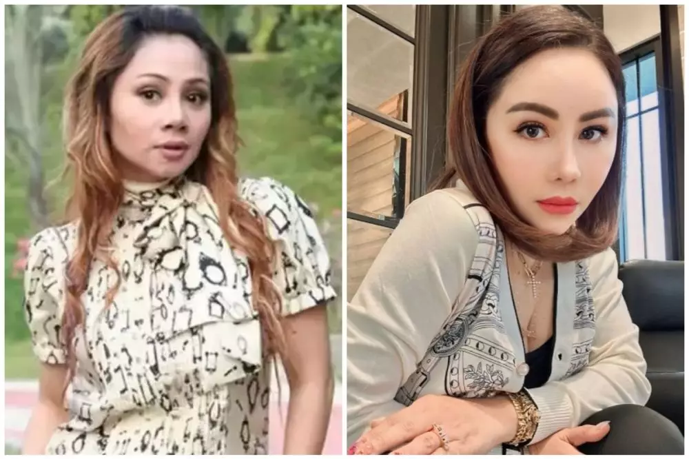 seleb 50an sebelum sesudah operasi plastik © berbagai sumber