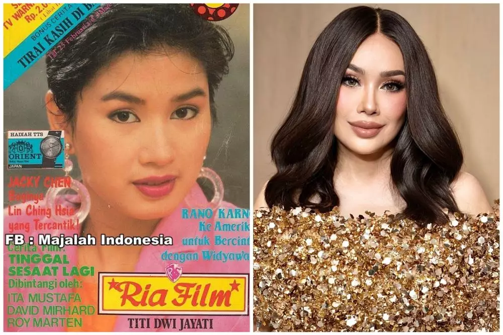 seleb 50an sebelum sesudah operasi plastik © berbagai sumber