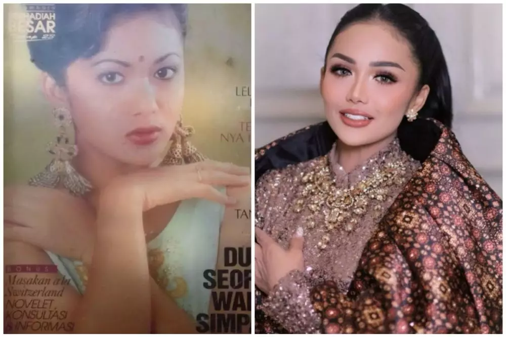 seleb 50an sebelum sesudah operasi plastik © berbagai sumber