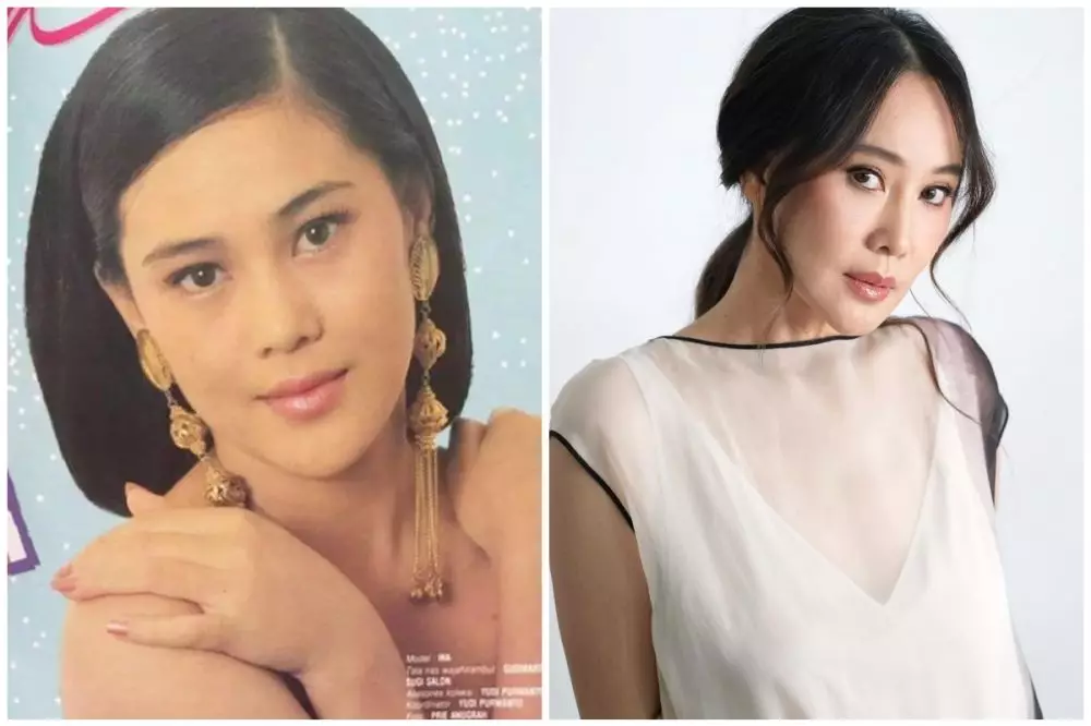 seleb 50an sebelum sesudah operasi plastik © berbagai sumber